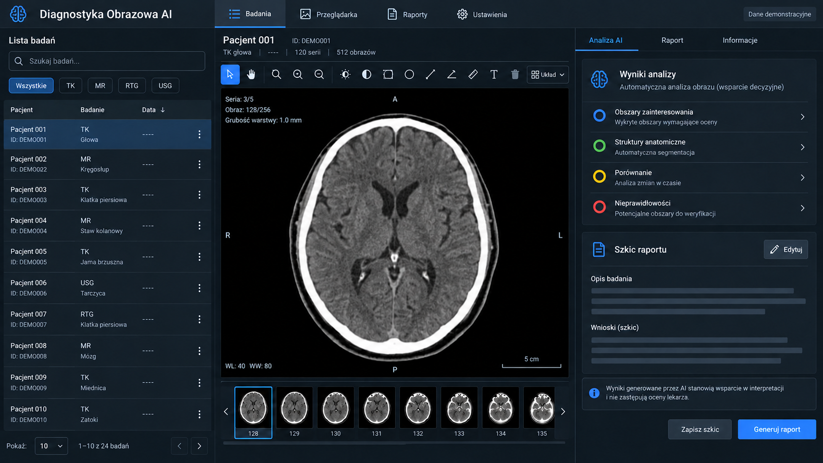 Diagnostyka Obrazowa AI
